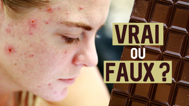 chocolat & acné© chocolat & acné©